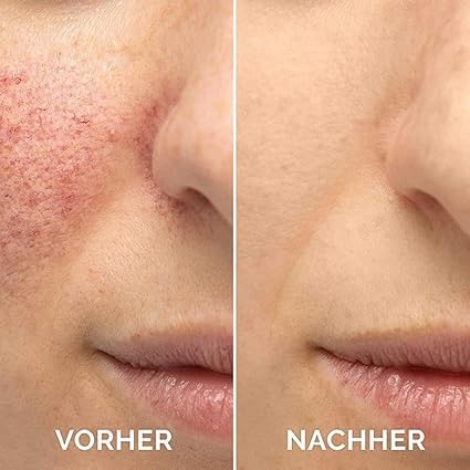 2PCS Vitamin C Facial Serum Essence, Hydration, Skin Moisturized, Vitamin C Serum, Anti Aging & Wrinkle Facial Serum(30ml / 1.01oz)