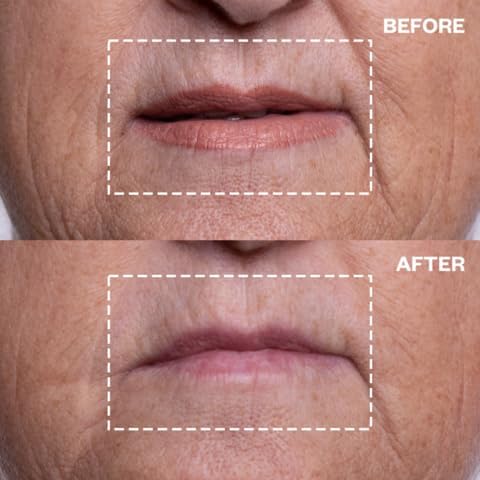 Wrinkles Schminkles Eye & Mouth Lift Set | Mouth & Lip Wrinkle Patch 2-Pack & Eye Wrinkle Patches 3-Pairs | Reusable Medical Grade Silicone Patches