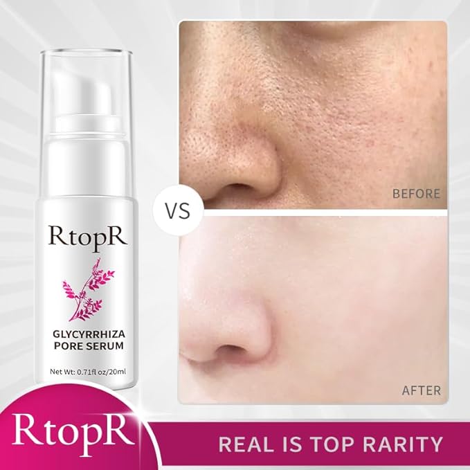 RtopR Glycyrrhiza Pore Soothing Serum