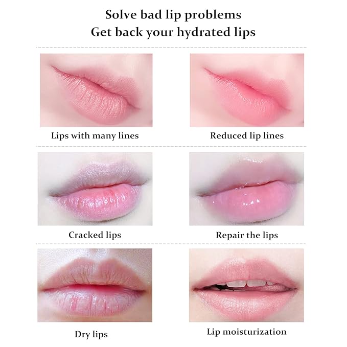 20Pcs Lip Mask Sheet,Red Cherry Moisturizing Plumping Lip Patches, Gel Treatment Lip Masks for Dry Lips Plump Lip Collagen Overnight Sleeping Lip Pads Patches(Red)