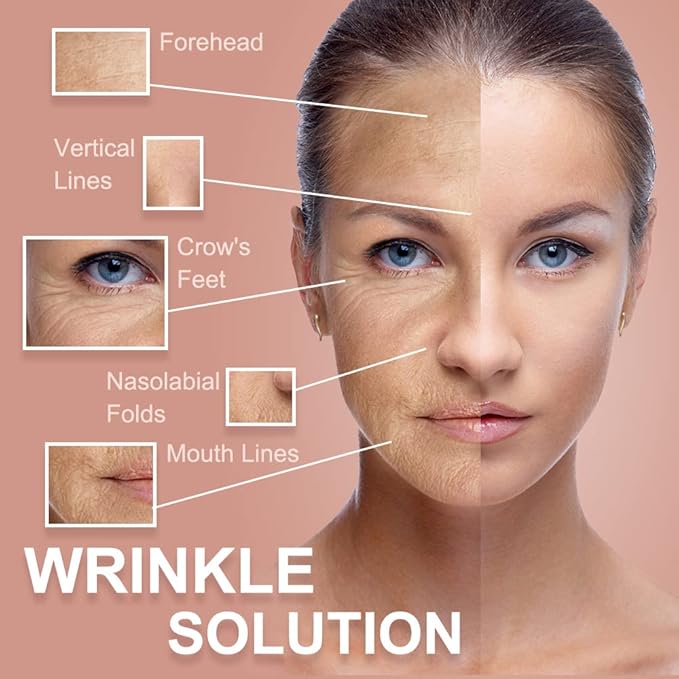 Akissos Face Tape Forehead Wrinkle Patches - Anti Lip Wrinkle Straw - Nose Lift - Facial Tape for Wrinkles - Eyes Neck Lips Wrinkle Reducer - Face Lift - Skin Lifting Tape - Face Shaper - 2.5cm*5m