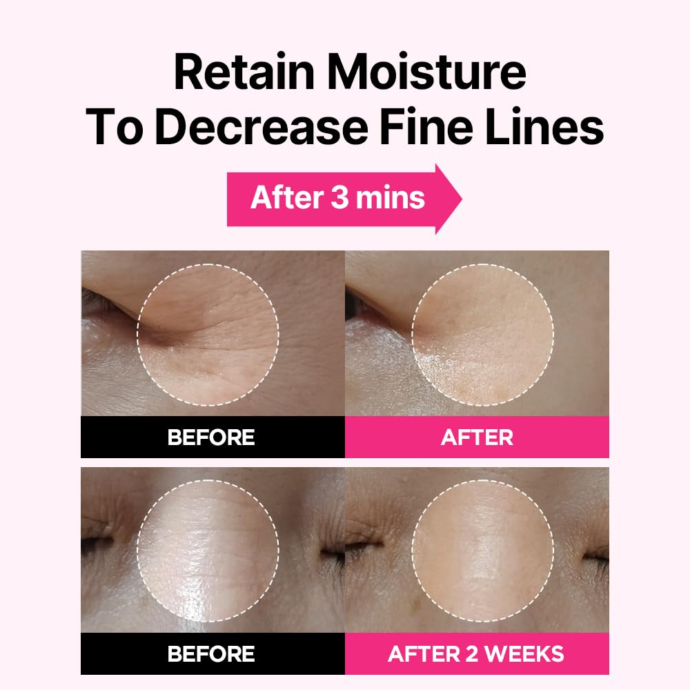 ISOI Blemish Care Up Facial Serum Triple Set, Korean Skin Care Set for Glass Skin Radiance, 2 Full Size & 1 Refill, Eye & Wrinkle Patch Tester, Daily Hydration Skincare Gift for Women (2.13 fl. oz)