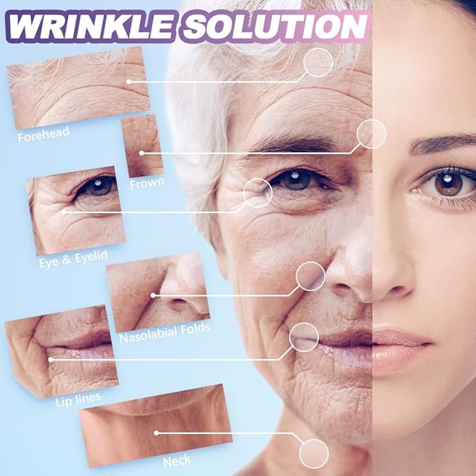 Wrinkle Patches, 160 PCS Face Tape, Pre Cut Kinesiology Full Face Tape for Wrinkles, V Line, Forehead, 11's, Frown, Eye, Lip - Neck Wrinkle Pads, Overnight Used High Elastic Facial Tape