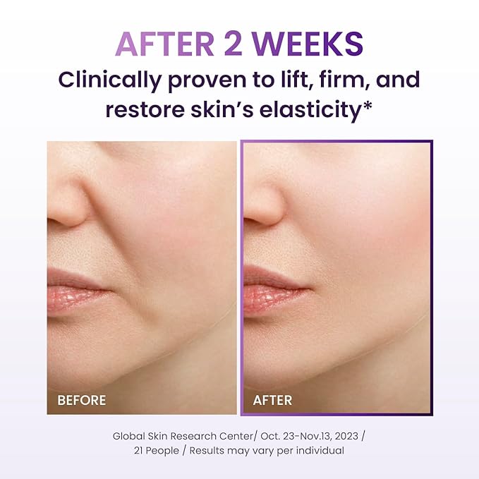 Probioderm 3D Lifting Cream + Cream Mist | Advanced Korean Anti-Aging Probiotic Facial Skincare with 17-Peptide Complex & Patented Probioderm for Wrinkles on Face and Neck