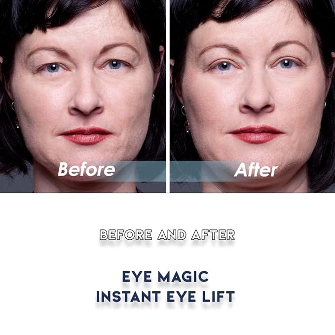 Premium Eye Lift (S/M Strips) Made in America. Instantly Lifts and Defines Droopy, Sagging or Hooded Eyes Safe for Daily Use