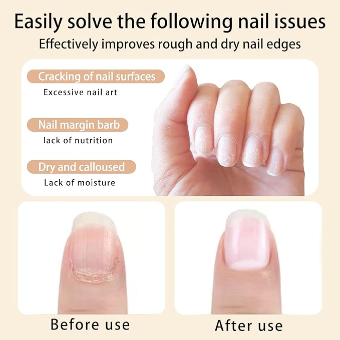 Scents Cuticle Oil Pen for Nails Care,Nail Oil For Strength,Nourish Moisten Care Cuticle To Reduce Nail Cracking and Dry for Weak Peeling Brittle and Thin Nails(apple&Strawberries&peaches)