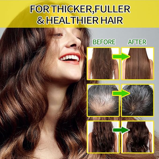 Hair Treatment Serum 40 Count- Vitamins Capsules with Argan Macadamia & Avocado Oils, Vitamin A, C, E, Pro B5, Leave-In Conditioner for Women & Men Frizzy Damaged Hair Repair, No Rinse; HFJN