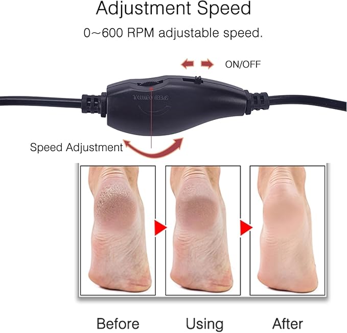 Electronic Foot File Grinder (Speed Adjustable) with 60pcs Replacement Sandpaper Disk,Electric Foot Scrubber Dead Skin Remover,for Feet Hard Cracked Dry Dead Skin Exfoliation,Unisex(Black)