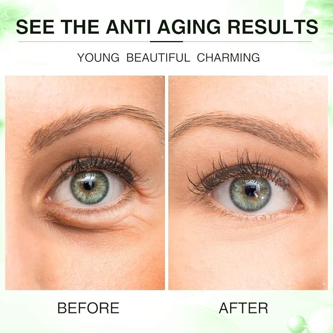 Under Eye Mask, Collagen Eye Mask, Eye Gel Pads, Green Tea Under Eye Patches, Firming Eye Mask, 30 Pairs Collagen Eye for Eye Moisturizing, Dark Circles, Wrinkles, Fine Lines, Under Eye Bags