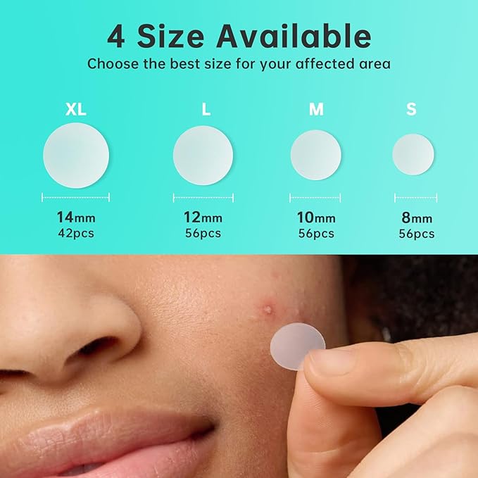 Pimple Patches for Face, Acne Patches/Hydrocolloid Patches for Covering Zits and Blemishes/Spot Care for Face,Absorb Fluid,4 size (210 Count)