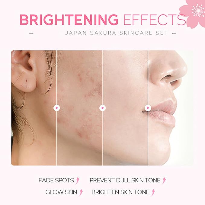 Skincare Gifts For Teenage Girls,Cherry Blossom Skincare Sets,Facial kit,Pamper Sets For Women Gifts,Skin Care Sets & Kits (One Size, Cherry Blossom-SetA-Base Moisturizing)
