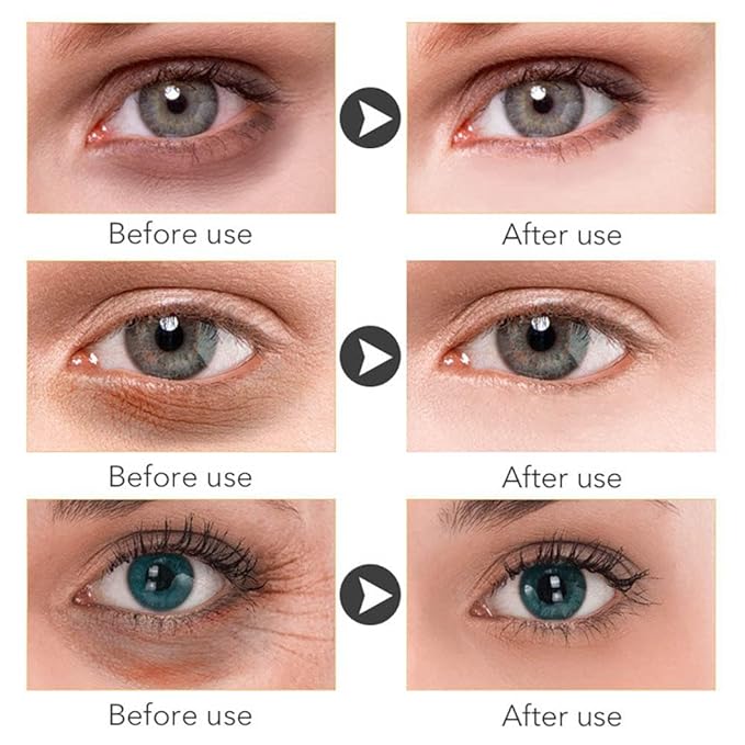 Magic Retinol Eye Cream for Dark Circles Puffiness and Bags Under Eyes, Instant Results Firm Eye Tightener Reduce Fine Lines Wrinkles Anti Aging Eye Cream for Men Women Suitable for Sensitive Skin