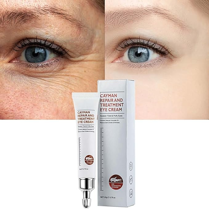 Magic Eye Cream, Instantly Remove Under Eye Bags Wrinkles Puffiness Dark Circles and Fine Lines, Anti Aging Eye Cream for Men Women