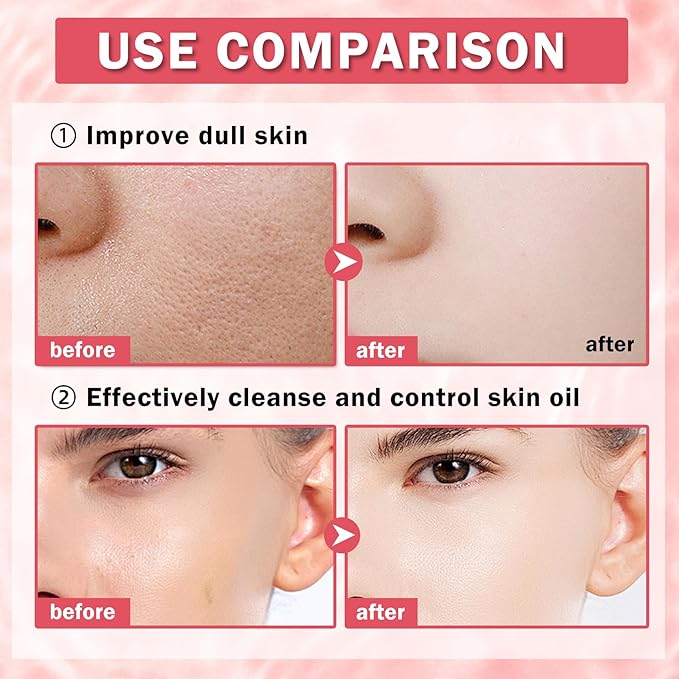 Facial Masks for Women Skin Care,10 Pack Kids Face Masks Spa,Hydraiting Hyaluronic Acid Face Mask Set for Girls,Natural Ingredients Mascarillas Faciales Para Niñas