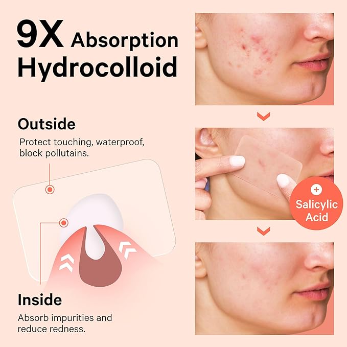 Sosky Large Pimple Patches XL Hydrocolloid Acne Patches for Face & Body Cystic Pimple & Zit Patch for Nose Chin Back, Bacne & Breakouts Vegan Cruelty-Free(8 Count)