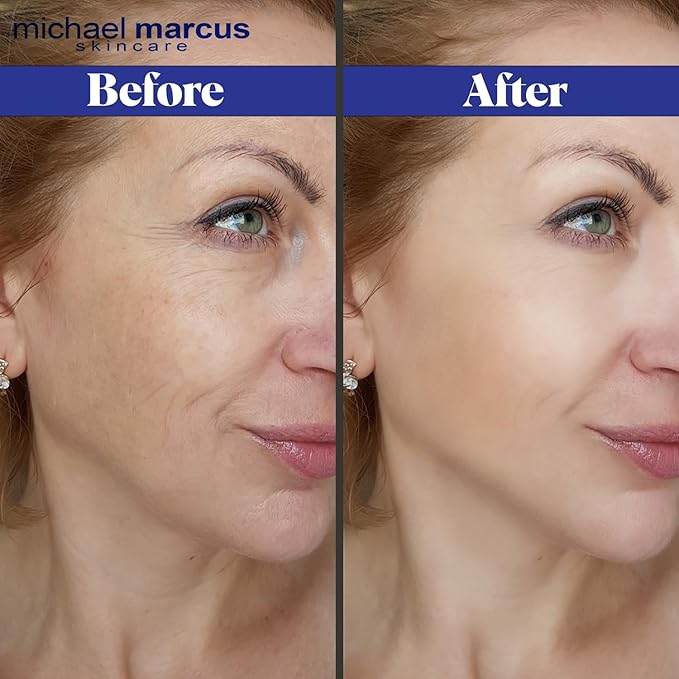 Micheal Marcus Hydromarineโข Eye Lift Serum - Reduces Wrinkles, Puffiness, Fine Line & Dark Circles - Under Eye Serum Improves Skin Elasticity, Skin texture & Brighten Complexion (30ml, 1 fl. oz)