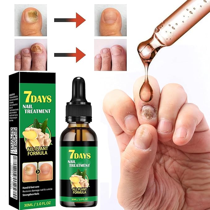 2PCS Ginger Nail Treatments, 7 Days Ginger Cuticle Care Oil for Nails,Nail Repair Cuticles Oil,Ginger Nail Oil for Strengthen nails & Promote Nail Growth, Natural Plant Formula