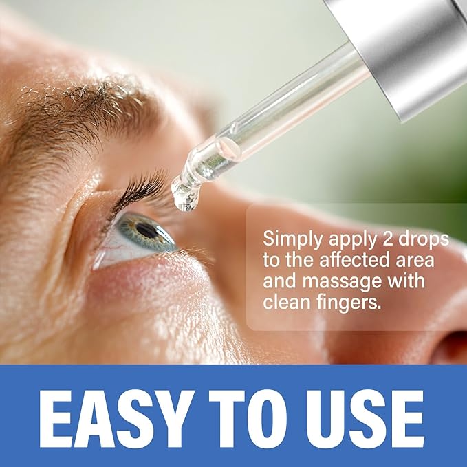 St_ye Eye Treatment, Natural Eye Serum for Chalazion and Blepharitis Treatment, Leading to Soothed and Restored E-ye Areas, 1 Fl.oz