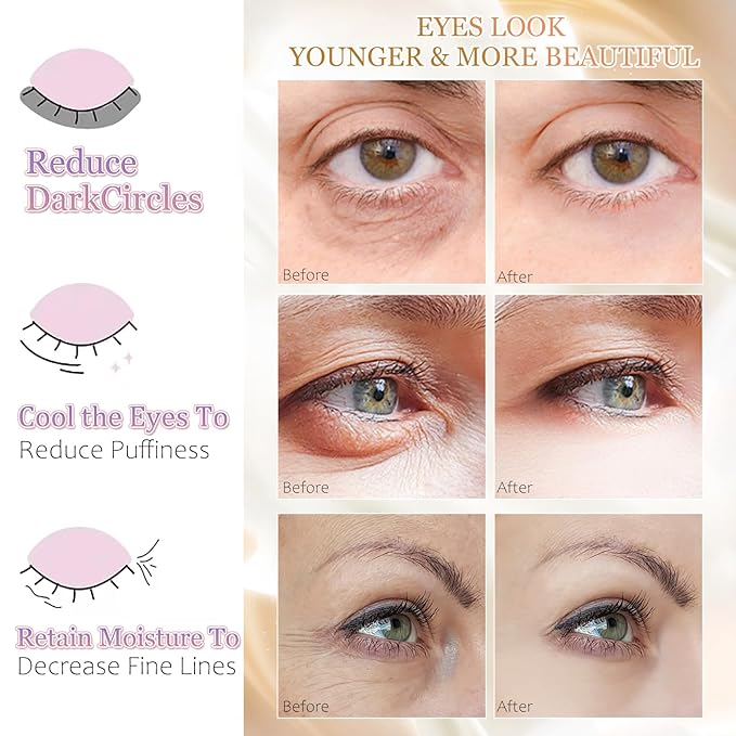 MOND'SUB Premium Under Eye Patches, Gel Eye Patches Hydrating & Refresh for Puffy Eyes, Under Eye Bags & Dark Circles, Natural Collagen Eye Gels Pads, Crystal Anti-Aging Eye Mask (Purple)