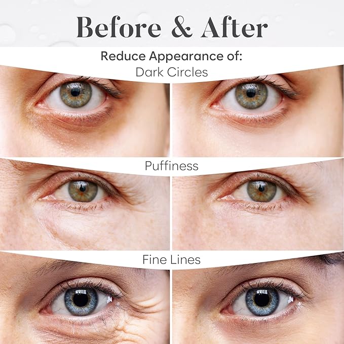 Variety Under Eye Patches (30 Pairs) Under Eye Patches for Dark Circles, Under Eye Patches for Puffy Eyes and Dark Circles, Eye Masks Bulk, Eye Care, Puffy Eyes Treatment, Under Eye Mask