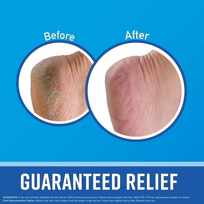 O'Keeffe's for Healthy Feet Foot Cream - 3 oz Travel Size Tube (1 Pack) - Guaranteed Relief for Extremely Cracked, Dry Feet, Repairing Skincare, Instantly Boosts and Retains Moisture Levels