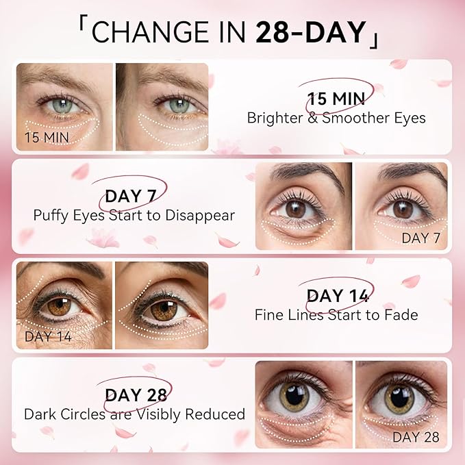 BREYLEE Pink Rose Eye Mask– 60 Pcs - Puffy Eyes and Dark Circles Treatments – Look Younger and Reduce Wrinkles and Fine Lines Undereye, Improve and Firm eye Skin - Pure Natural Material Extraction