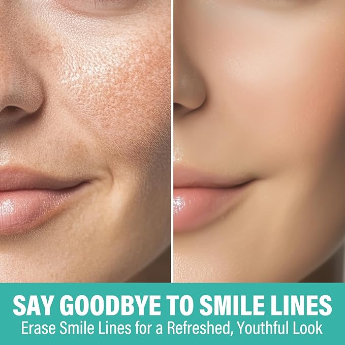 Smile Line Patches, 16pcs Anti-Wrinkle Facial Tapes, Smooth Fine Lines & Wrinkles, Gentle Face Lifting Stickers, Laugh Line Masks for a Youthful Smile