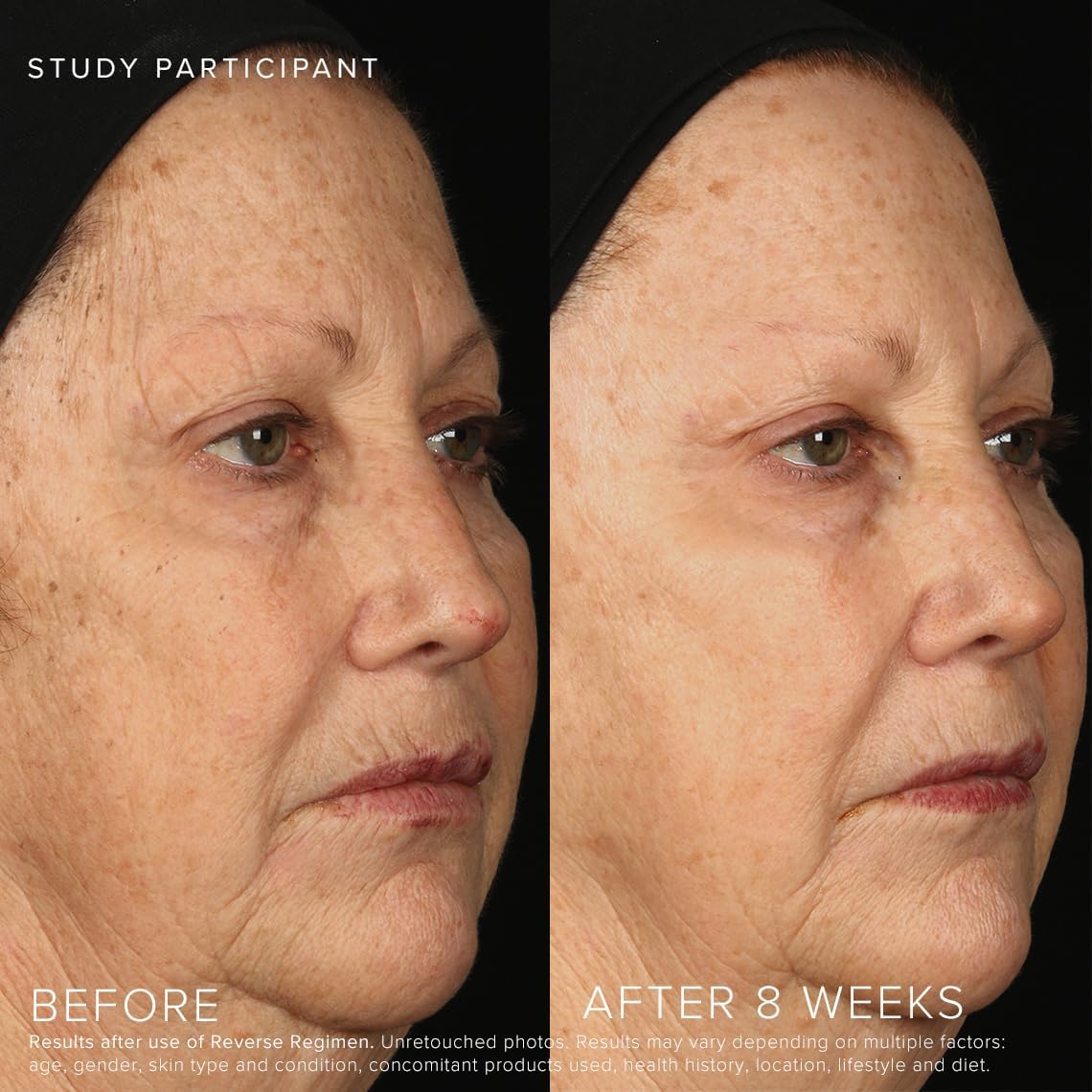 Rodan + Fields Reverse Regimen: Cleanser, Toner, Lotion SPF 50, & Treatment | Daily Moisturizer | Contains Vitamin C & Retinol | Skincare Sets & Kits | Face Wash for Women | Self Care