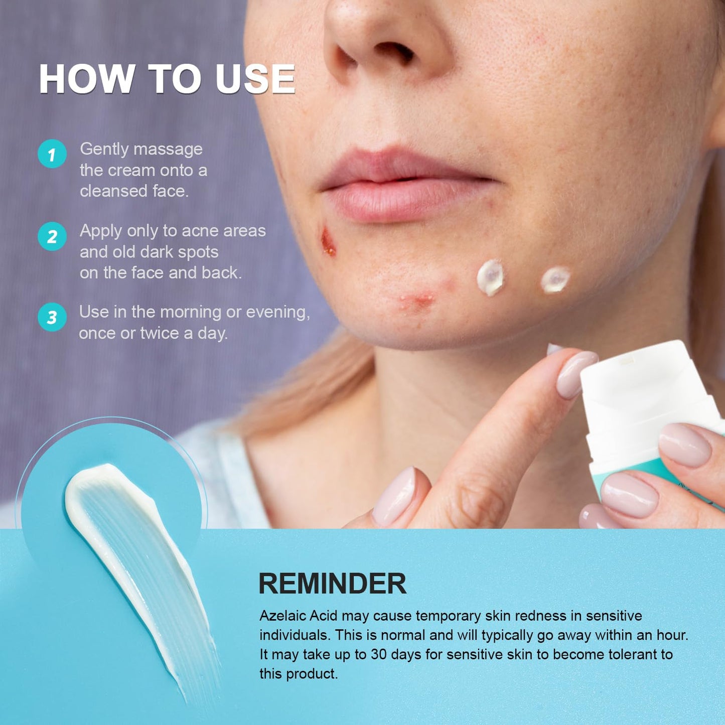 Acne Pimple Spot Treatment Cream: Cystic Hormonal Blackheads Blemish Remover for Face, Back and Body - with 10% Azelaic Acid - Teens 13-19 & Young Adult 20-30, 1.8 oz