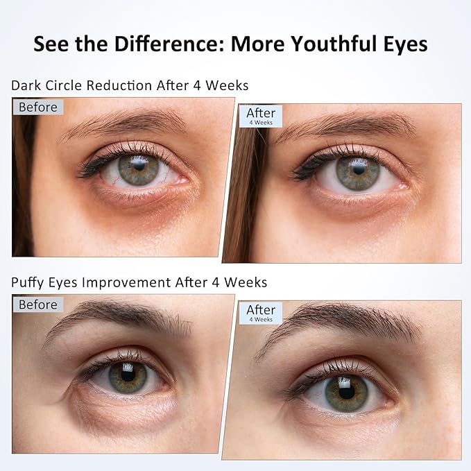 Caffeine Eye Cream for Dark Circles, Puffiness & Puffy Bags - Under Eye Serum with Caffeine, Niacinamide, Hyaluronic Acid, Vitamin E & Peptides, 0.7 Fl Oz (Pack of 2)