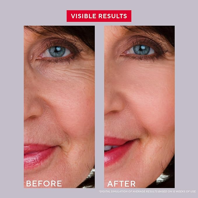 Mirabella Replenish & Restore Multi-Peptide Anti Aging Face Serum for Hyperpigmentation & Redness Relief - Vitamin C & 0.5% Retinol Infused Dark Spot Corrector