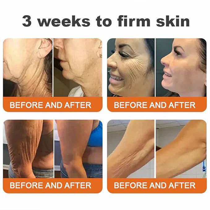 Botox Bee Venom Firming Serum Stick, Advanced Firming & Wrinkle-Reducing Cream, Bee Venom Wrinkle Remover Cream, Bee Venom Firming Serum Stick, Hydrates & Nourishes Skin (2PCS)