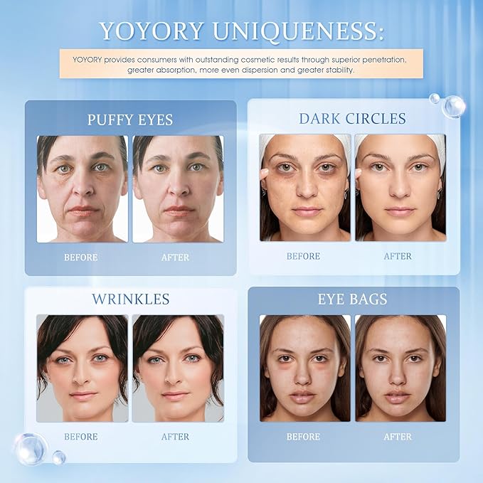 Under Eye Patches Masks - for Eye bags,Dark Circles,and Fine Lines,puffiness Smoothing Skin Care Treatment with Collagen and Hyaluronic Acid for Women and Men, (60 Pcs) Blue