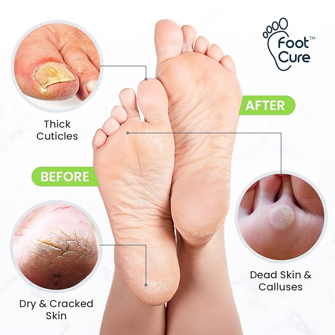Toenail Repair Pedicure Kit with Muscle Relief Foot Soak with Epsom Salts - All Natural Salts for Post Workout Recovery - Softens Calluses - Soothes Sore Tired Feet