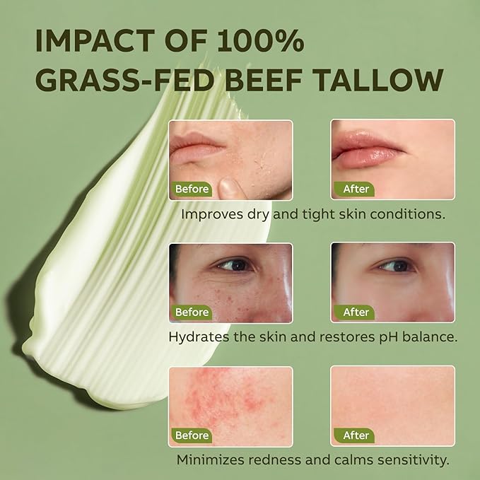 Beef Tallow for Skin, Beef Tallow and Honey Balm, All-Natural Moisturizer Nourishes and Hydrates the Skin Face Body, Grass Fed Whipped Tallow Honey Balm with Honey 60ml