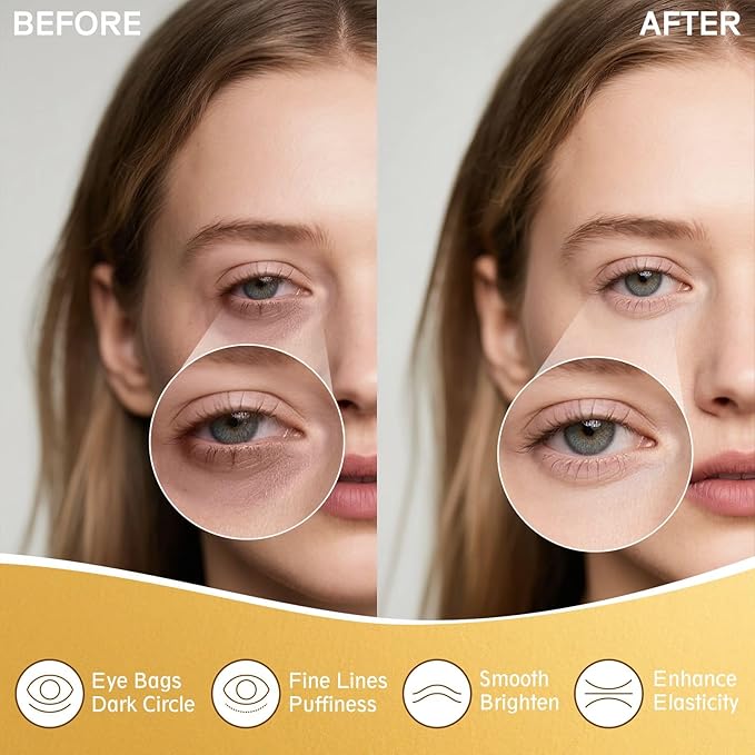 Under Eye Patches for Puffy Eyes and Dark Circles, 20 Pairs Eye Mask with Hyaluronic Acid & Collagen, Anti Wrinkle Patches for Nourishing, Moisturizing, Fine Lines Eye Care Treatment
