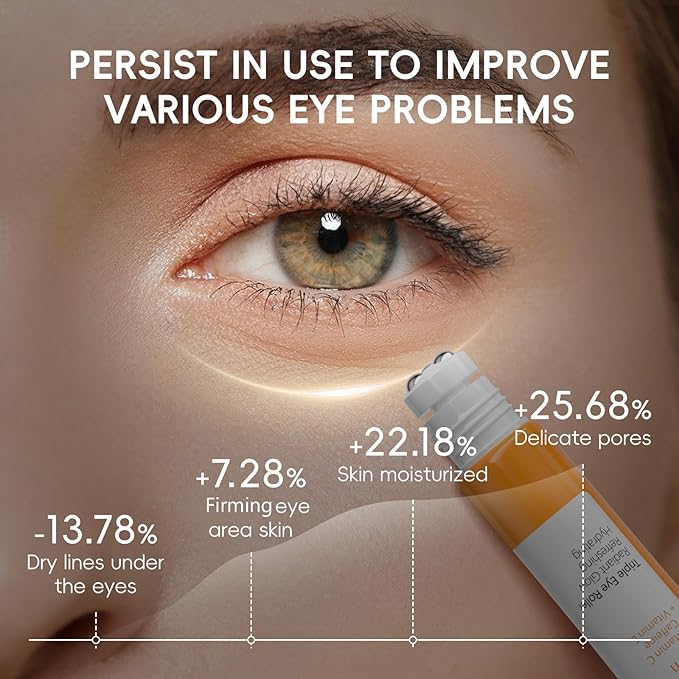 Easilydays Vitamin C Eye Cream & Under Eye Serum, Refreshing, Hydrating, Radiant Glow Eye Care Eye Roller Serum with 360° Massage Ball, Tightening Under Eye Serum for Women Reduce Wrinkles Fine Lines