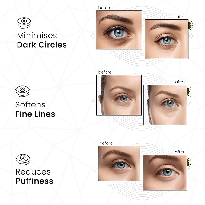 Pure Vegan Under Eye Patches, Helps Reduce Puffy Eyes & Dark Circles, Revitalise Dull Eye Masks - Nourishes, Renews, Soothes (Jar - 30 Pair)