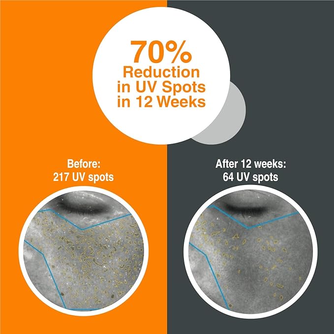 PHOTOZYME iQuad Total Eye Therapy with DNA Repair Enzymes | Anti Aging Eye Cream | Use to Reduce Bags, Dark Circles, Puffiness | Firms and Tightens The Delicate Skin Surrounding The Eye | 0.5 Fl Oz