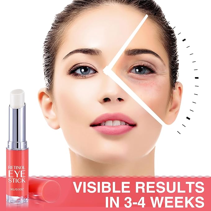 Retinol Eye Stick, Retinol Eye Cream, Under Eye Brightener Stick for Dark Circles, Eye Cream Anti Aging, Eyes Treatment Products for Fine Lines, Bags, Wrinkles, Puffiness 0.1oz(3g)