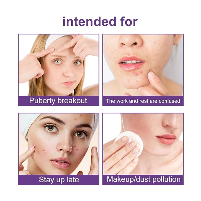 144 PCS Acne Patches Cute Pimple Patches for Face and Skin - Hydrocolloid Acne Treatment Dots to Cover and Reduce Zits, Blemishes, Spots, Star Pimple Patch