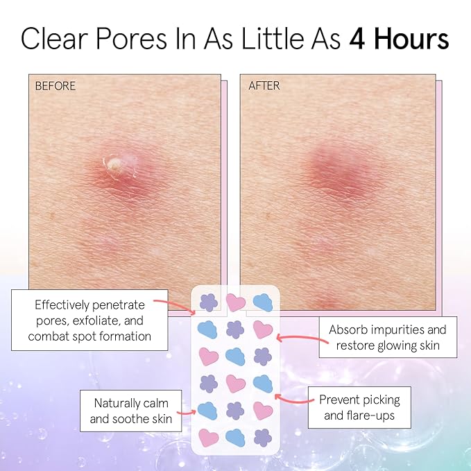 grace & stella Pimple Patches for Face - Cute Hydrocolloid Dots That Help Protect Acne & Reduce Redness - Fun Zit Stickers to Cover Blemishes - Dermatologist-Tested, Vegan (Multishape, 36 Count)