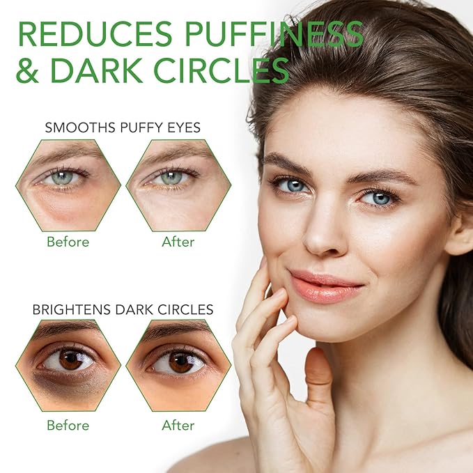 Aloe Veoe Eye Patches,Hydrogel Under Eye Masks for Dark Circles,Anti Wrinkle Treatment,Under Eye Gel Pads,Eye Mask for Puffy Eyes, Skincare,Hydrating | 60 Pieces/30 Pairs
