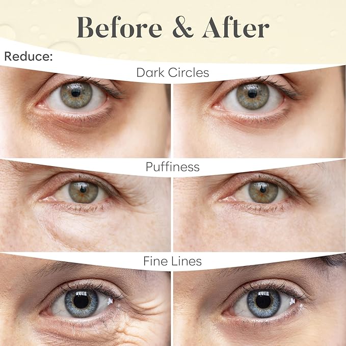 24K Gold Under Eye Patches (30 Pairs) Under Eye Patches for Dark Circles, Under Eye Patches for Puffy Eyes and Dark Circles, Under Eye Mask, Eye Care, Puffy Eyes Treatment