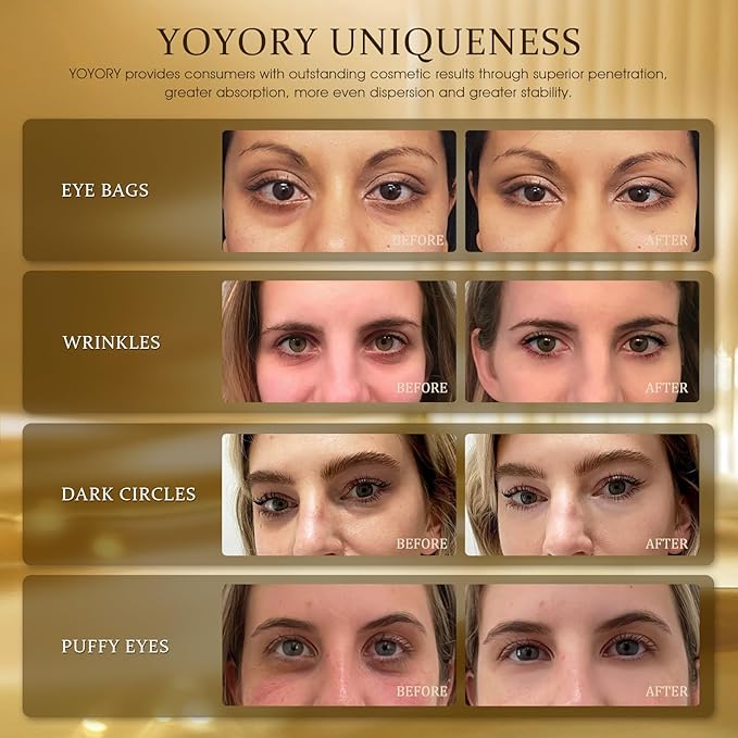 Hydrogel Eye Patches for Dark Circles, Puffy Eyes & Wrinkles - Collagen & Hyaluronic Acid Infused Under Eye Masks, Hydrating Firming Care, Fine Lines,Eye Bags Reduction (60 Pcs) Gold