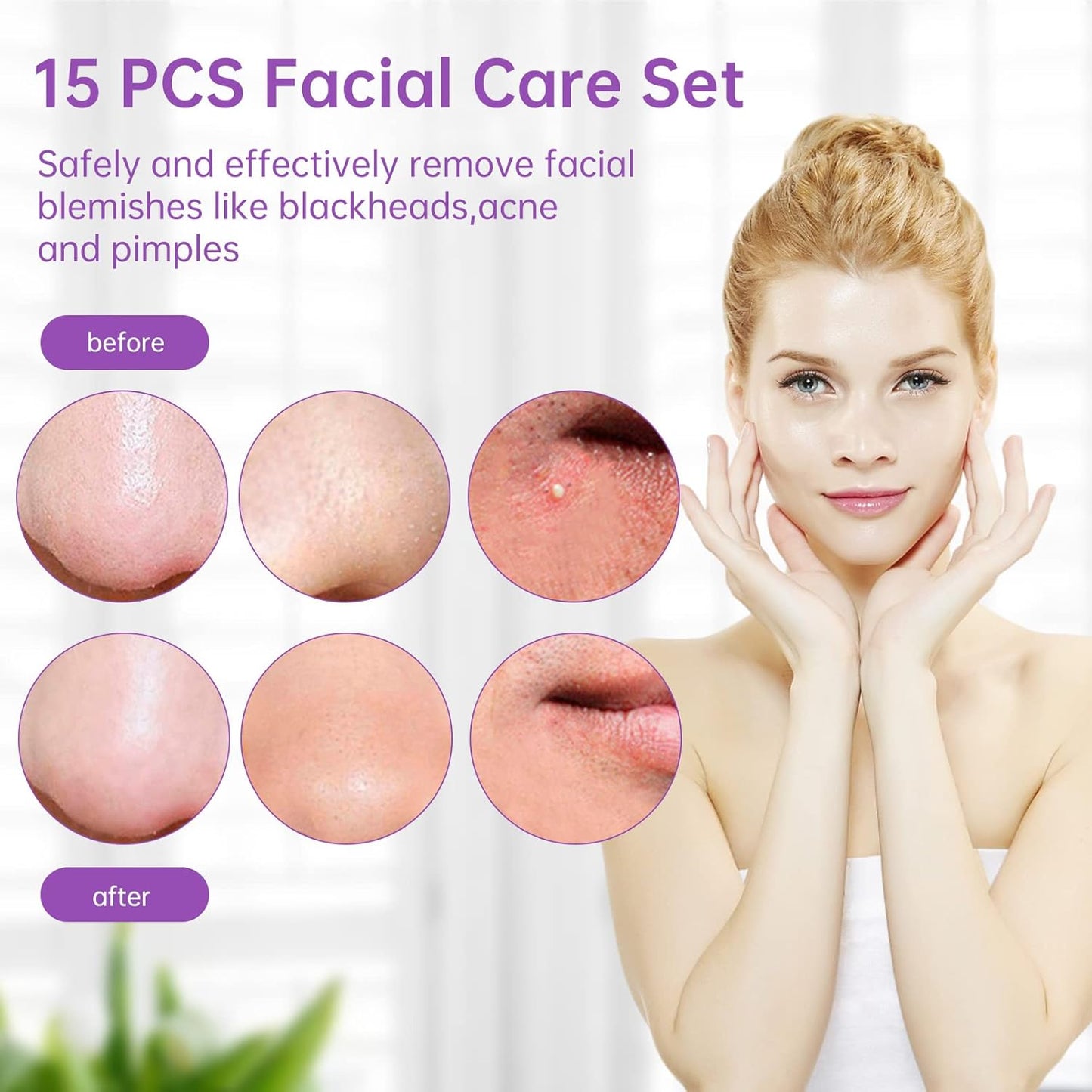 15 PCS Pimple Popper Tool Kit,Blackhead Remover Comedone Extractor Tools,Professional Pimple Comedone Extractor,Stainless Steel Skin Blemish Removal Acne Tools for Forehead Nose Face with Metal Case