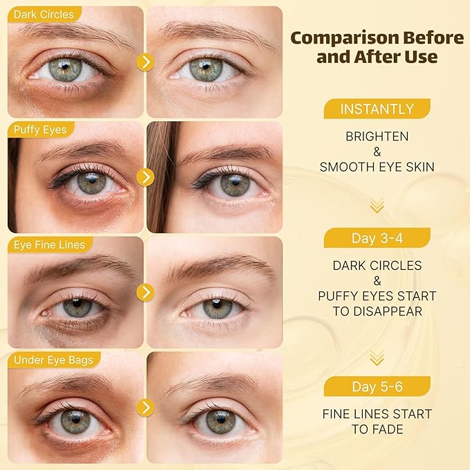Under Eye Patches for Puffy Eyes and Dark Circles, 20 Pairs Eye Mask with Hyaluronic Acid & Collagen, Anti Wrinkle Patches for Nourishing, Moisturizing, Fine Lines Eye Care Treatment