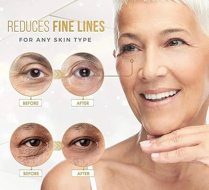 24k Gold Eye Treatment Masks With Collagen