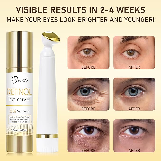 Retinol Eye Cream with Eye Massage Instrument, Infused with 5% Caffeine and Hyaluronic for Dark Circles Treatments, Under Eye Care Anti Aging Reduce Under Eye Bags Fine Lines, Gifts for women