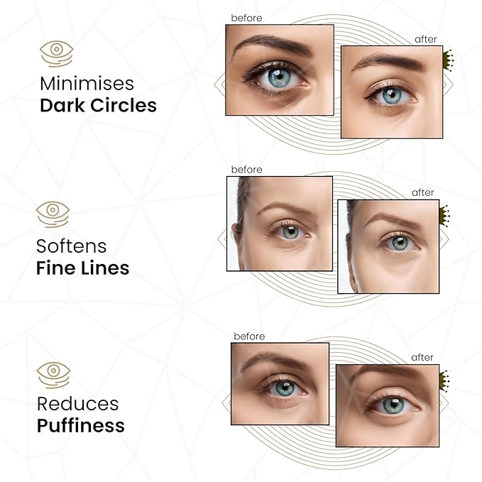 24k Gold Under Eye Collagen Patches, Reduce Puffy Eyes & Dark Circles, Illuminate Tired Eye Masks - Firms, Brightens, Energises (Packets - 30 Pair)